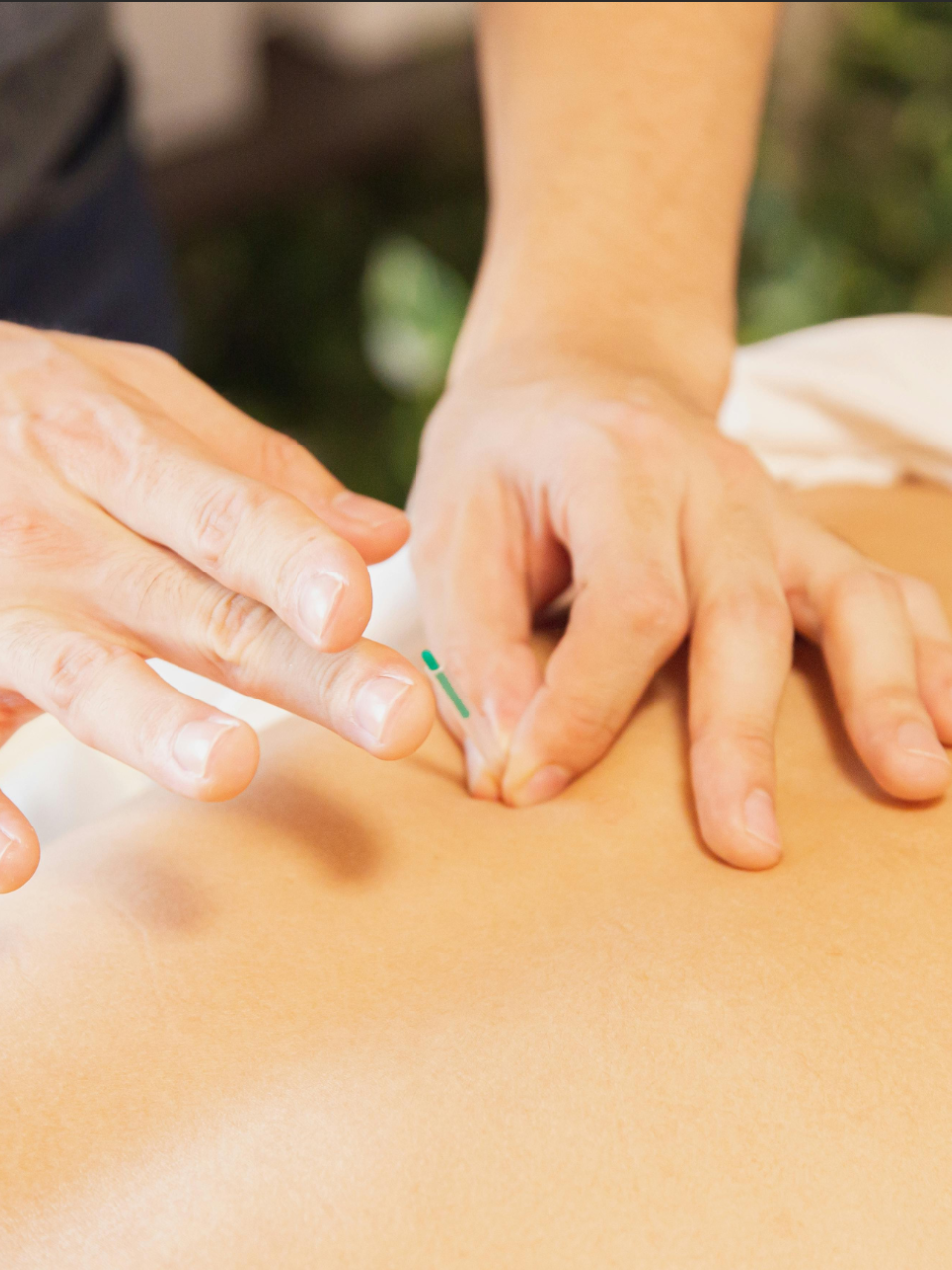 Physio service-needling